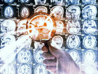 Mind 20 MRI