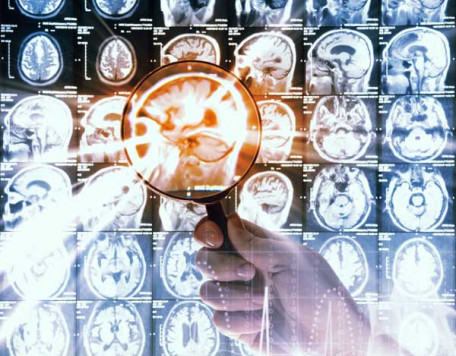 Mind 20 MRI